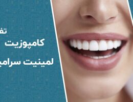 فرق لمینت و‌ کامپوزیت دندان